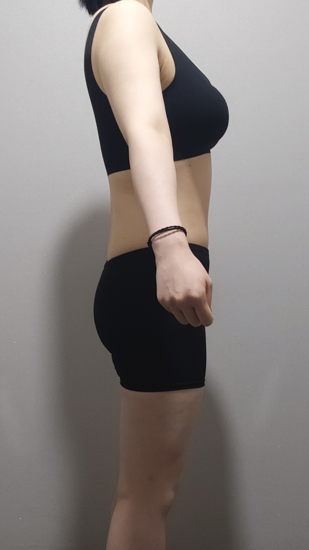 -5.2 사례 복용 후 사진